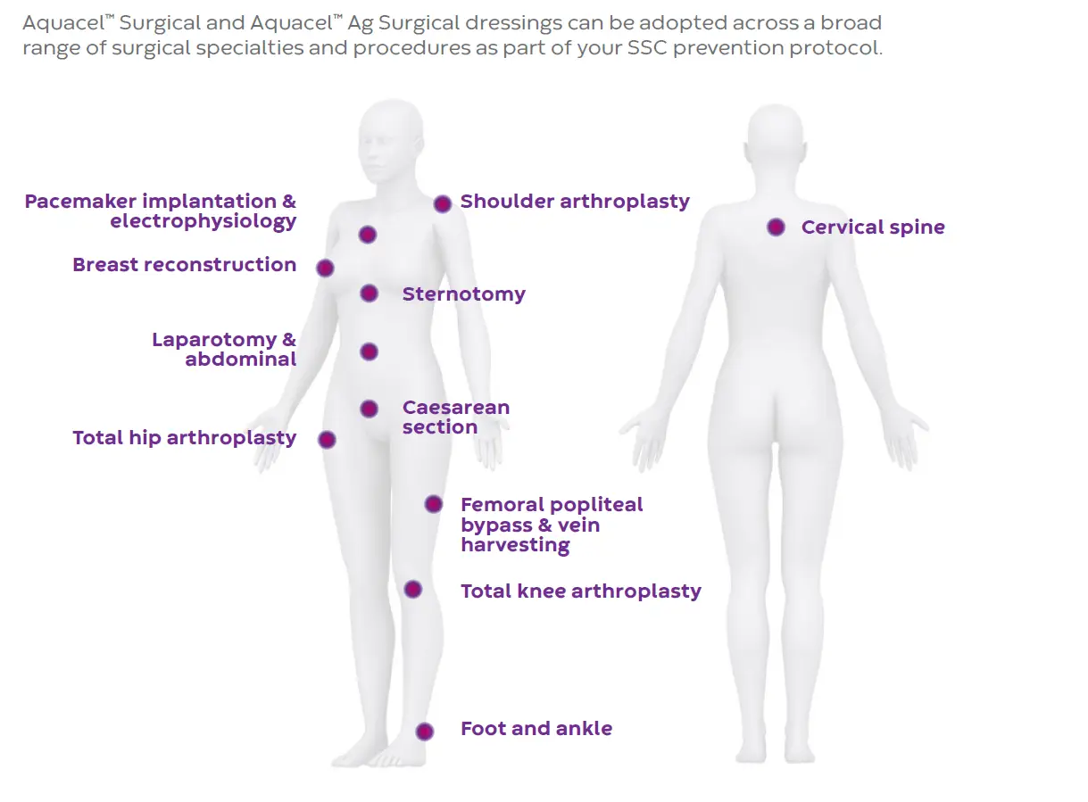 operacije aquacel surgical ag