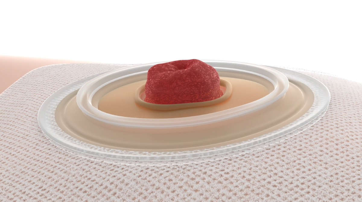 modlable tehnologija delovanje