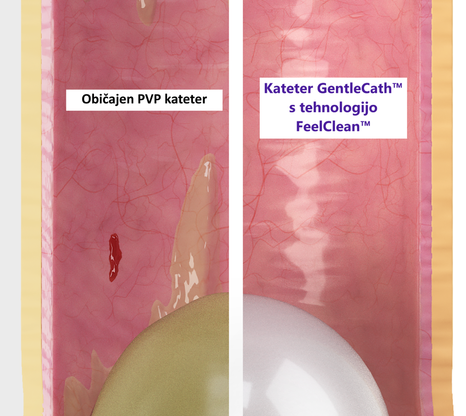 Urinski katetri pvp kateter gentlecath kateter za samokateterizacijo